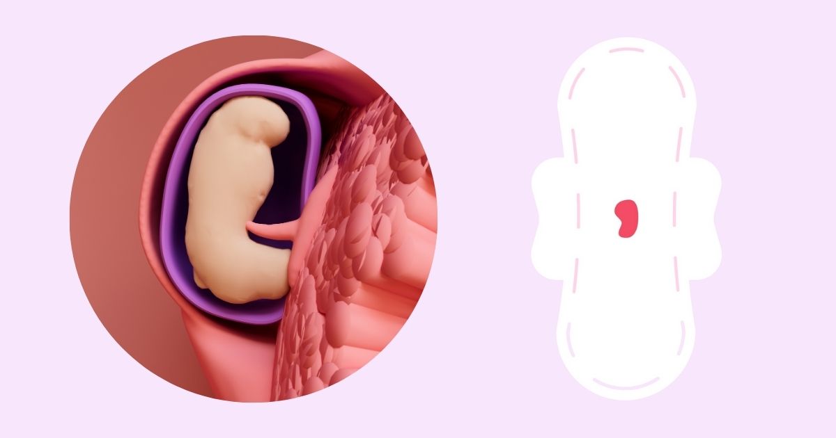 implantacne krvacanie - spinenie